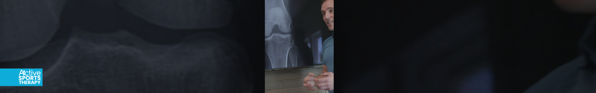 Preventing Stress Fractures in Young Athletes: A Guide for Parents