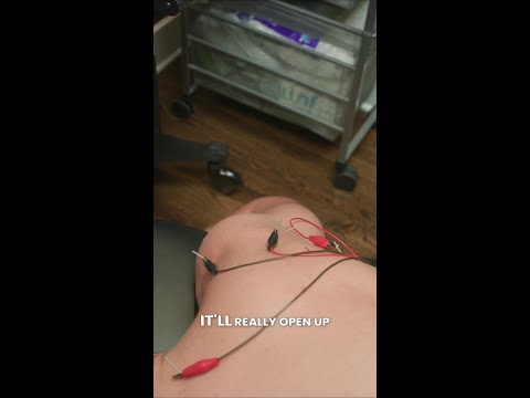 Dry Needling for Shoulder Recovery | Hendersonville TN